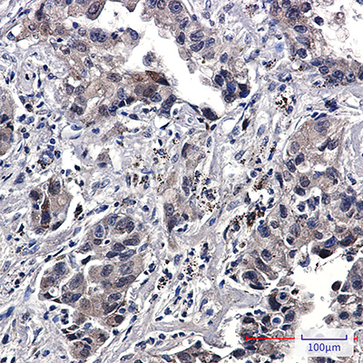 Phospho-EGFR (Tyr1173) Rabbit Monoclonal Antibody | 兔单抗 | EnkiLife恩玑生命