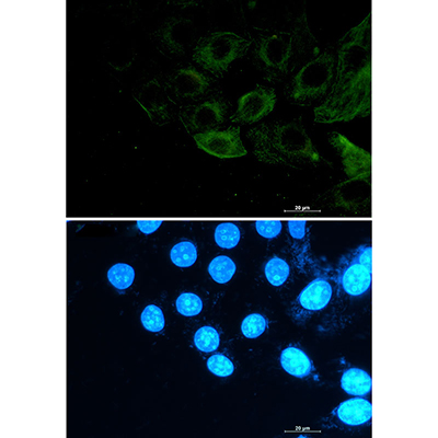 Phospho-Filamin A/B (Ser2152/Ser2107) Rabbit Monoclonal Antibody | 兔单抗 | EnkiLife恩玑生命