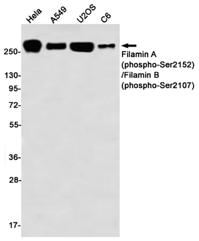 Phospho-Filamin A/B (Ser2152/Ser2107) Rabbit Monoclonal Antibody | 兔单抗 | EnkiLife恩玑生命