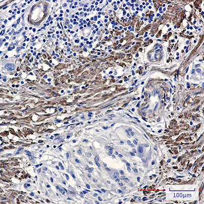 Phospho-Filamin A/B (Ser2152/Ser2107) Rabbit Monoclonal Antibody | 兔单抗 | EnkiLife恩玑生命
