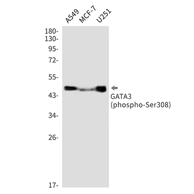 Phospho-GATA3 (Ser308) Rabbit Monoclonal Antibody | 兔单抗 | EnkiLife恩玑生命