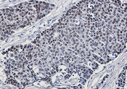 Phospho-GATA3 (Ser308) Rabbit Monoclonal Antibody | 兔单抗 | EnkiLife恩玑生命