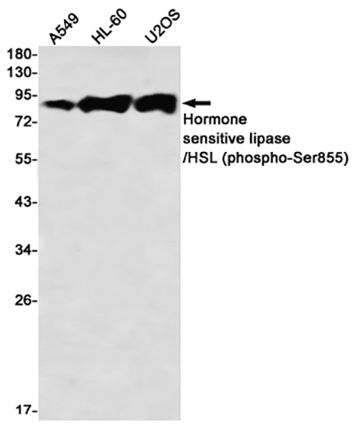Phospho-Hormone Sensitive Lipase (Ser855) Rabbit Monoclonal Antibody | 兔单抗 | EnkiLife恩玑生命