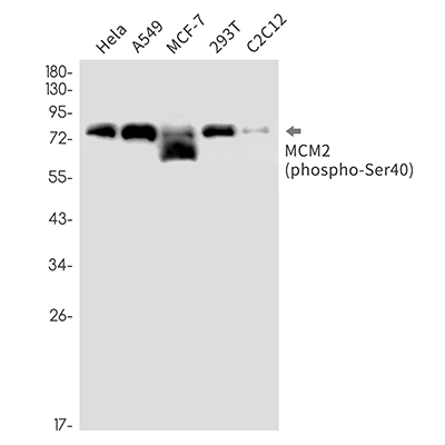Phospho-MCM2 (Ser40) Rabbit Monoclonal Antibody | 兔单抗 | EnkiLife恩玑生命