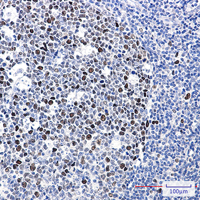 Phospho-MCM2 (Ser40) Rabbit Monoclonal Antibody | 兔单抗 | EnkiLife恩玑生命