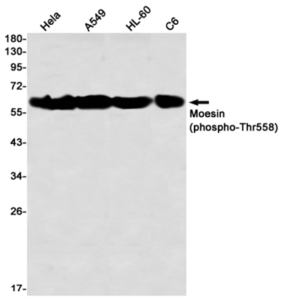 Phospho-Moesin (Thr558) Rabbit Monoclonal Antibody | 兔单抗 | EnkiLife恩玑生命