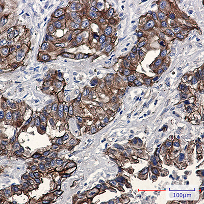 Phospho-Moesin (Thr558) Rabbit Monoclonal Antibody | 兔单抗 | EnkiLife恩玑生命