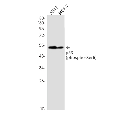 Phospho-p53 (Ser6) Rabbit Monoclonal Antibody | 兔单抗 | EnkiLife恩玑生命