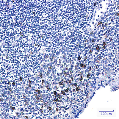 Phospho-p53 (Ser6) Rabbit Monoclonal Antibody | 兔单抗 | EnkiLife恩玑生命