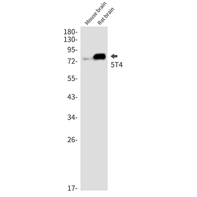 5T4 Rabbit Monoclonal Antibody | 兔单抗 | EnkiLife恩玑生命