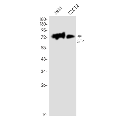 5T4 Rabbit Monoclonal Antibody | 兔单抗 | EnkiLife恩玑生命