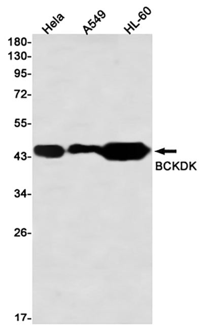 BCKDK Rabbit Monoclonal Antibody | 兔单抗 | EnkiLife恩玑生命