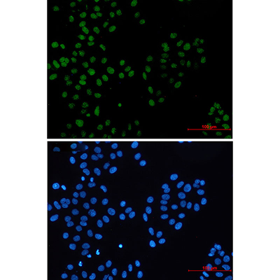 BMI1 Rabbit Monoclonal Antibody | 兔单抗 | EnkiLife恩玑生命