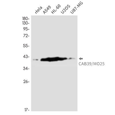 CAB39 Rabbit Monoclonal Antibody | 兔单抗 | EnkiLife恩玑生命