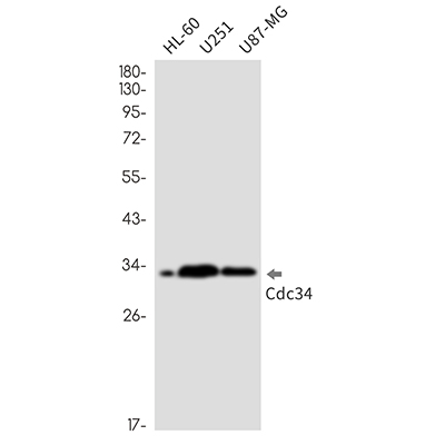 CDC34 Rabbit Monoclonal Antibody | 兔单抗 | EnkiLife恩玑生命