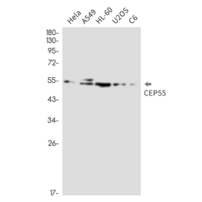 CEP55 Rabbit Monoclonal Antibody | 兔单抗 | EnkiLife恩玑生命