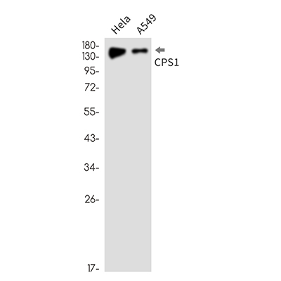 CPS1 Rabbit Monoclonal Antibody | 兔单抗 | EnkiLife恩玑生命