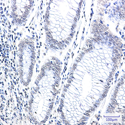 CPS1 Rabbit Monoclonal Antibody | 兔单抗 | EnkiLife恩玑生命