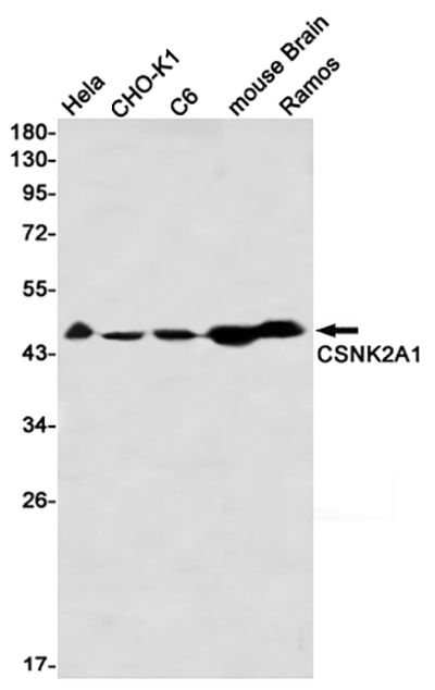 CSNK2A1 Rabbit Monoclonal Antibody | 兔单抗 | EnkiLife恩玑生命