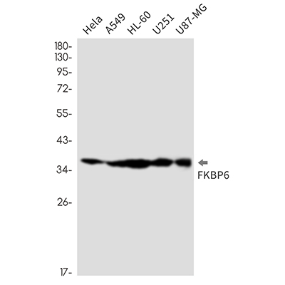 FKBP6 Rabbit Monoclonal Antibody | 兔单抗 | EnkiLife恩玑生命
