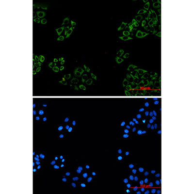FXR1 Rabbit Monoclonal Antibody | 兔单抗 | EnkiLife恩玑生命