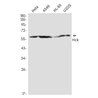 Tyrosine Protein Kinase HCK Rabbit Monoclonal Antibody | 兔单抗 | EnkiLife恩玑生命