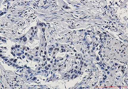 HIF1 beta Rabbit Monoclonal Antibody | 兔单抗 | EnkiLife恩玑生命