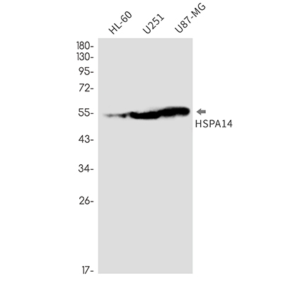 HspA14 Rabbit Monoclonal Antibody | 兔单抗 | EnkiLife恩玑生命