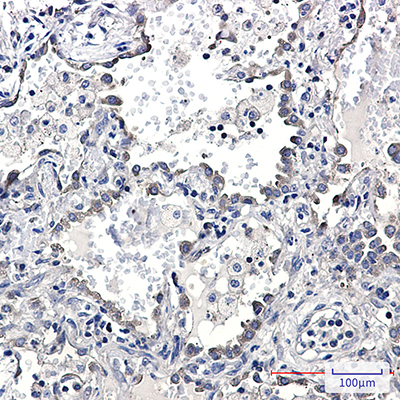 KIFAP3 Rabbit Monoclonal Antibody | 兔单抗 | EnkiLife恩玑生命