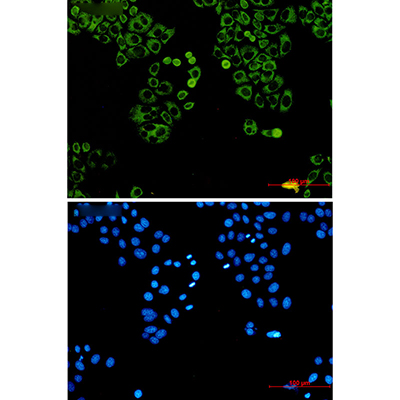 LYRIC Rabbit Monoclonal Antibody | 兔单抗 | EnkiLife恩玑生命