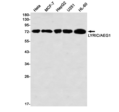 LYRIC Rabbit Monoclonal Antibody | 兔单抗 | EnkiLife恩玑生命