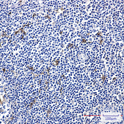MERTK Rabbit Monoclonal Antibody | 兔单抗 | EnkiLife恩玑生命
