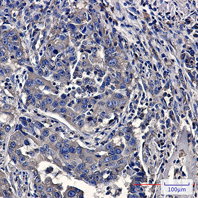 Moesin Rabbit Monoclonal Antibody | 兔单抗 | EnkiLife恩玑生命