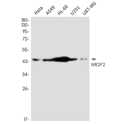 NR2F2 Rabbit Monoclonal Antibody | 兔单抗 | EnkiLife恩玑生命