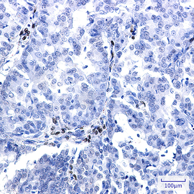 NR2F2 Rabbit Monoclonal Antibody | 兔单抗 | EnkiLife恩玑生命