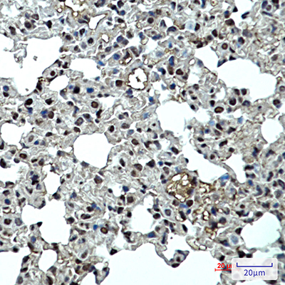 p27 Kip 1 Rabbit Monoclonal Antibody | 兔单抗 | EnkiLife恩玑生命