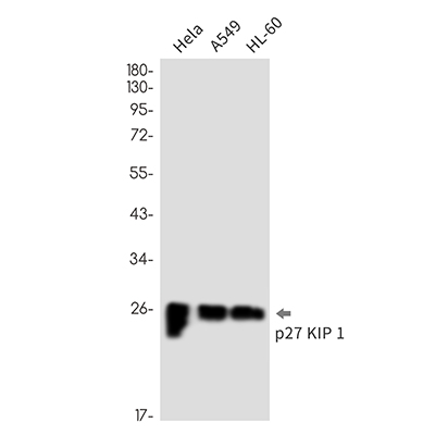 p27 Kip 1 Rabbit Monoclonal Antibody | 兔单抗 | EnkiLife恩玑生命
