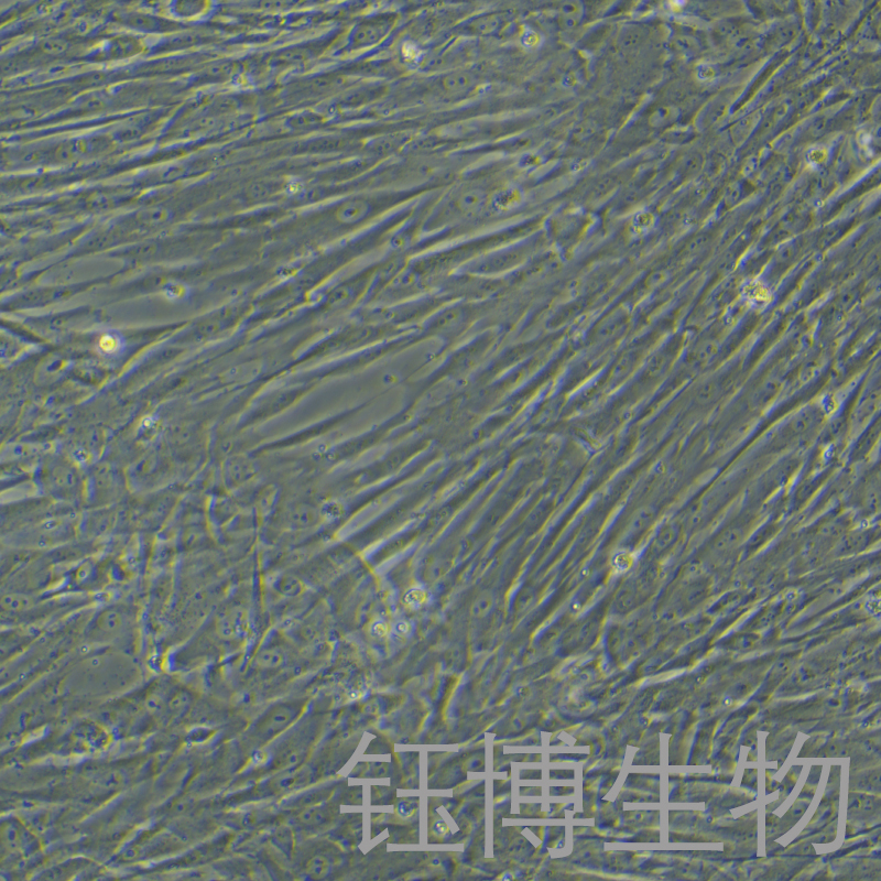 HTMC（人眼小梁网细胞）YB-71795HC