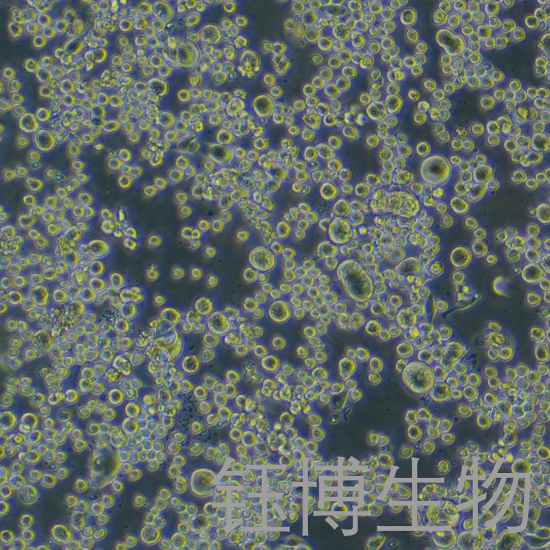 H22-LUC（小鼠肝癌带荧光素酶标记细胞）YB-7033MC