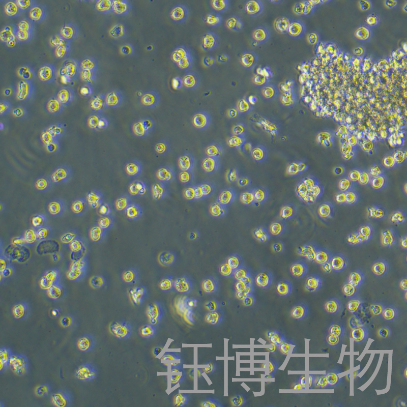 MonoMac6（人急性单核细胞白血病细胞）YB-71808HC