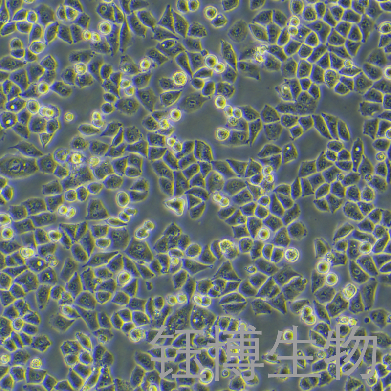 IOSE-80（人正常卵巢上皮细胞）YB-71809HC