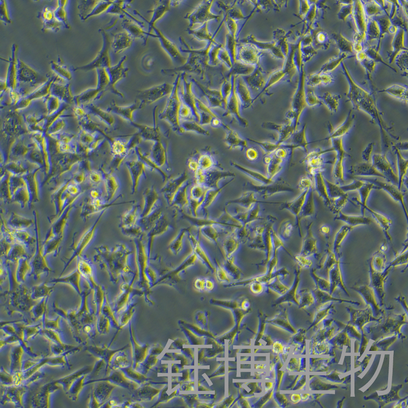 U87MG+LUC（人恶性胶质瘤细胞带荧光素酶）YB-71813HCL