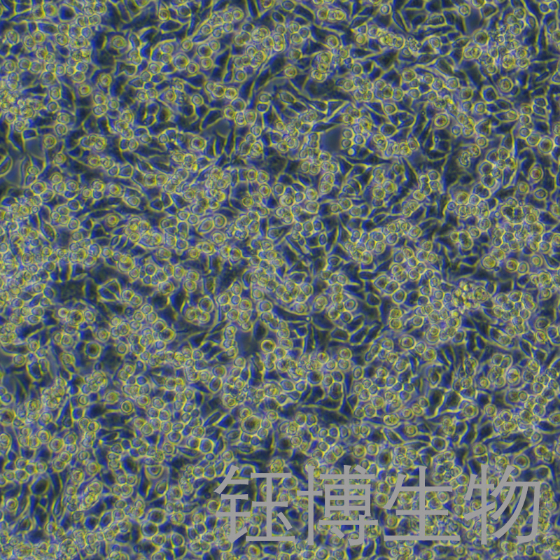 MB-49（小鼠膀胱癌细胞）YB-7034MC