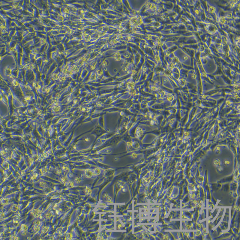 MBT-2（小鼠膀胱癌细胞）YB-7035MC