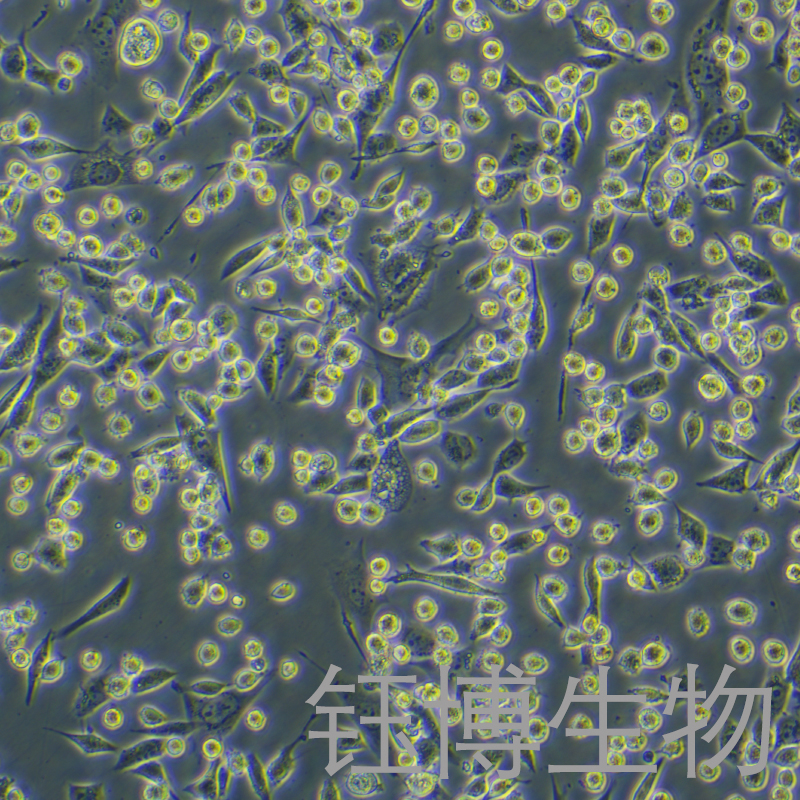 LLC-LUC（萤火虫荧光素酶标记的小鼠肺癌细胞）YB-7036MC-L