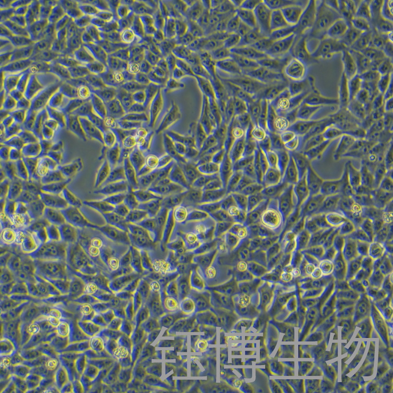 VX2（兔间变表皮鳞癌瘤株）YB-7006OC