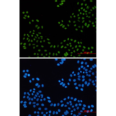 PELP1 Rabbit Monoclonal Antibody | 兔单抗 | EnkiLife恩玑生命