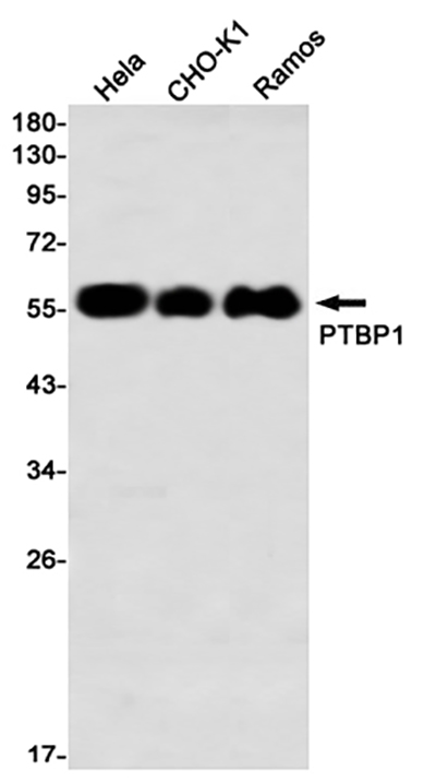 PTBP1 Rabbit Monoclonal Antibody | 兔单抗 | EnkiLife恩玑生命