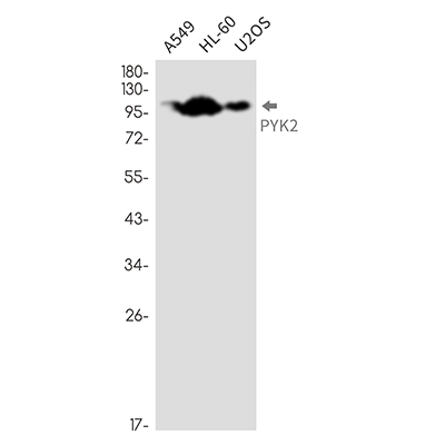 PYK2 Rabbit Monoclonal Antibody | 兔单抗 | EnkiLife恩玑生命