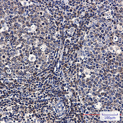 PYK2 Rabbit Monoclonal Antibody | 兔单抗 | EnkiLife恩玑生命